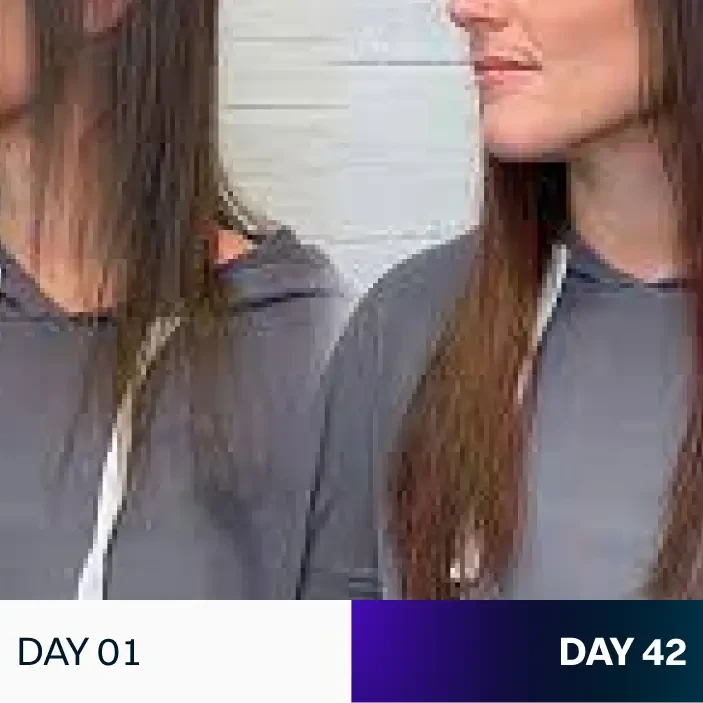 PURWATER™ - THE DERMA SHOWERHEAD (The One Skio)